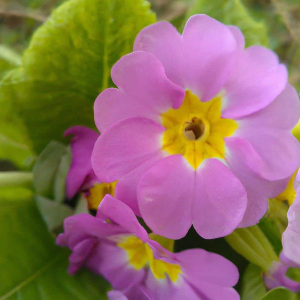 Ruyada Ameliyata Hazirlandigini Gormek