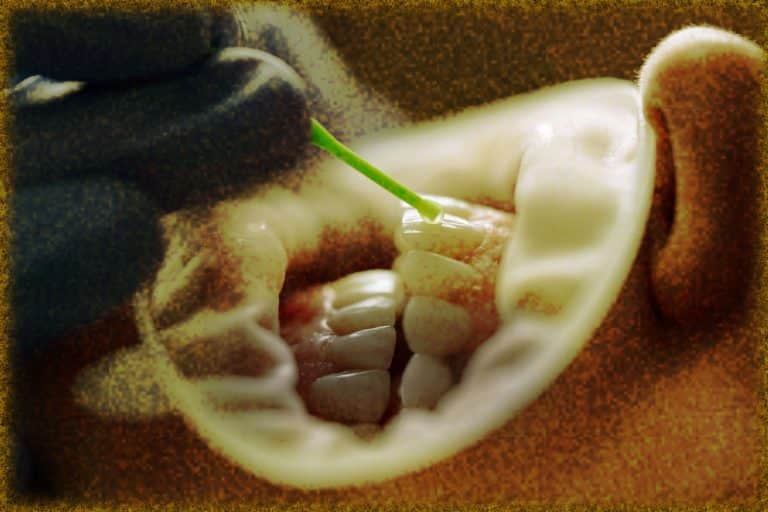 Rüyada Diş Dökülmesi