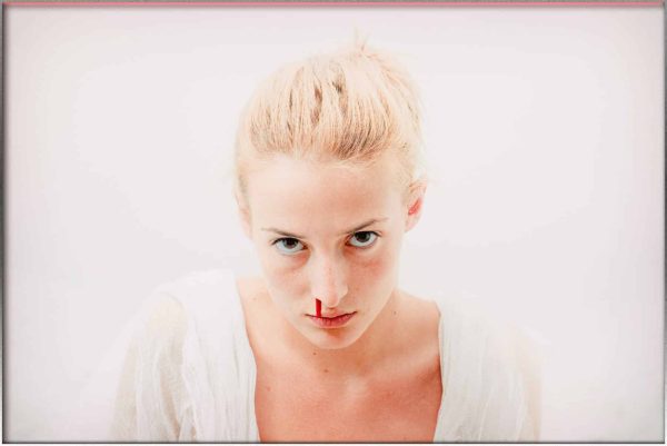 Rüyada Burun Kanaması