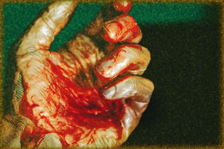 Rüyada Başkasında Kan Görmek